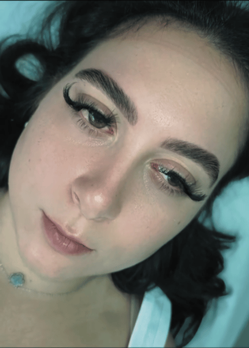 gallery image of facial treatment