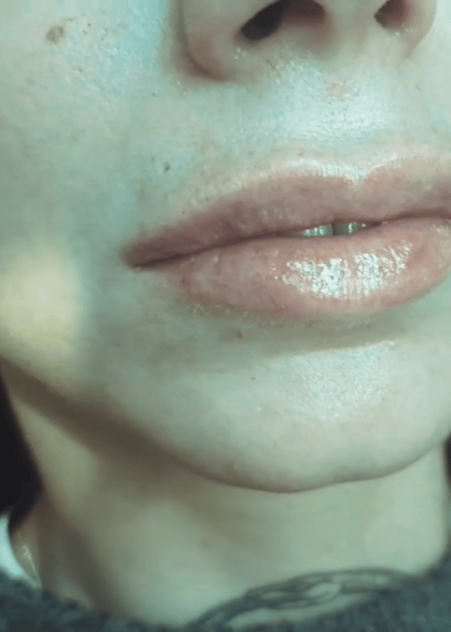 gallery image of brows