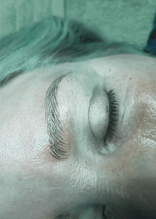 gallery video placeholder